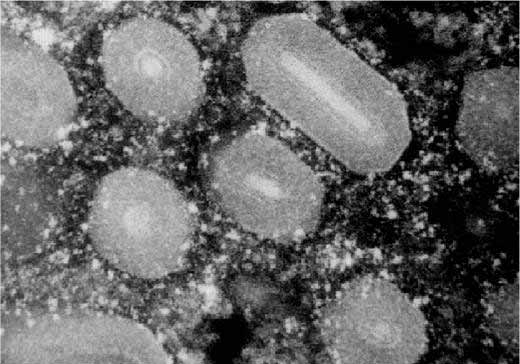 Almamoly granulovirus elektronmikroszkóp alatt szexferomonját, mintegy feromonfelhőbe burkolva a teljes ültetvényt.