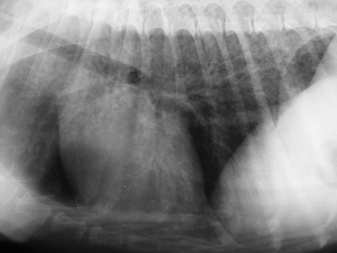 interstitiumban ( oedema, vérzés, fibrosis,