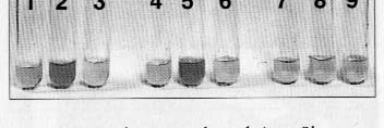 : 9-33 5-50% R: 5,3 <5 mg/l Fibrinogén: 3,6-5,06 2-4 g/l sontvelő aspiratio (csontvelői érintettség megítélésére). Negatív Hemolízis okának felderítésére.