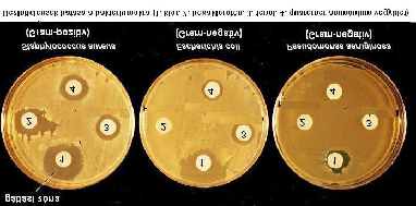 Dezinficiálás: mikroorganizmusok, elsõsorban pathogen ágensek számának csökkentését jelenti Cél: egészségügyi személyzet, betegek fertõzésektõl való védelme Antiszeptikum : bõr, mucosa élõ