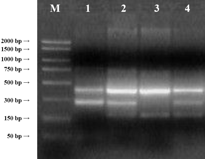 7. ábra Gélelektroforézis kép a GR gén Bcl I polimorfizmus új allél-specifikus PCR módszerrel történő kimutatására. 1.