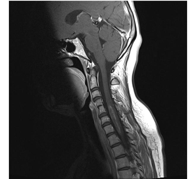 Neurosurg Psychiatry, 2010 SE Wales
