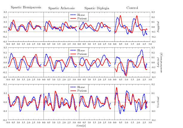 Gyógylovaglás Spasti Spastic c Athetos Hemip is Spasti c Dipleg Contr ia ol hát gyorsulás max[g] 0,088 0,102 0,08 0,193 derék gyorsulás max[g] 0,138 0,128 0,137 0,23 hát gyorsulás min[g] 0,069 0,07