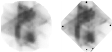 3. Fantomok Az abszorbeáló anyag valamilyen geometriáját fantomnak nevezzük Standard fantomok Vízfantom: TBA (Therapy Beam Analyzer) Anatómiai fantomok: Alderson-Rando fantom IMRT fantomok 4.