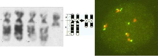 isochromosoma) Nincs ismert genetikai eltérés p53< 3%; bcl-2<