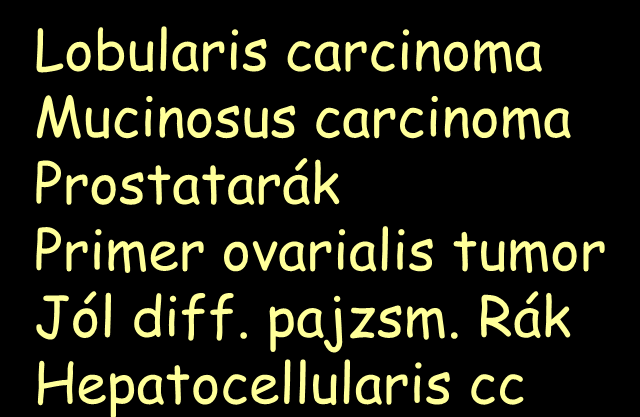 Tumorok és az FDG felvétel Melanoma Agressziv lymhoma Hodgkin betegség Colorectalis carcinoma NSCLC Nyelőcsőrák Fej/nyaki carcinoma Ductalis inv. cc Rosszul diff.