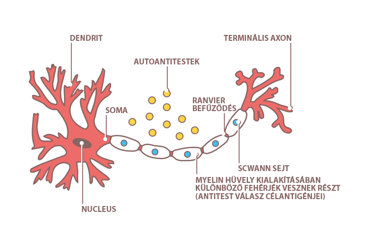 Immunopathogenesis Autoantitestek az antitest-függı celluláris cytotoxicitás révén demyelinisatiohoz vezetnek,