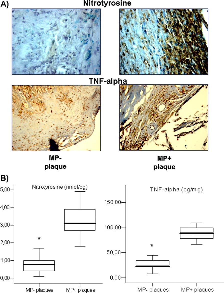 peak (MP-) and patients with MBPS peak (MP+) Marfella, R. et al.