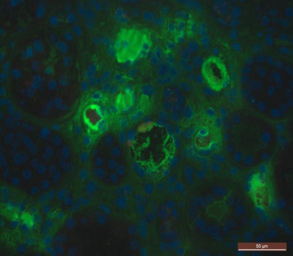 Complement, fibrin, thrombocyta