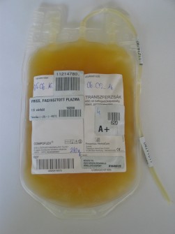 dilució Faktorok: 0,6-1,4 IU/ml TACO-TRIM-TRALI-citrát-pH 1E FFP 2,6% MOF 1E FFP 2,5% ARDS 1E FFP 3x fertőzés