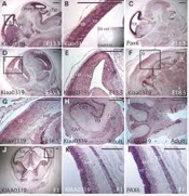 KIAA0319 Cerebral neocortex, hippocampus, midbrain és cerebelláris expresszió a