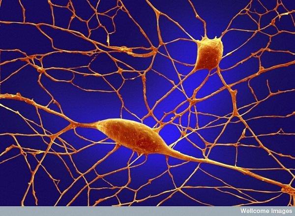 Egy neuron az emberi agyban található 100 milliárdból. A PURKINJE (ejtsd: purr-kinjee) neuronok a legnagyobbak közül valóak.