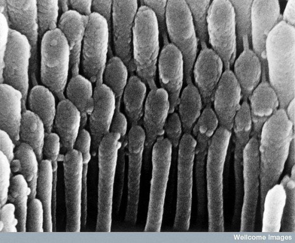 Szőrsejtek a fülben Ezen a képen az látható, amint az emberi szőrsejtek térhatású csillószőrei