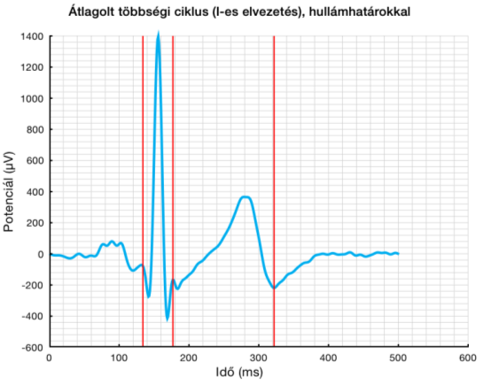 WIWE innováció!!! EKG-t mér, jelzést ad: 1. Normál EKG paraméterektől való eltérés 2. Pitvari fibrilláció (stroke kockázat) 3.