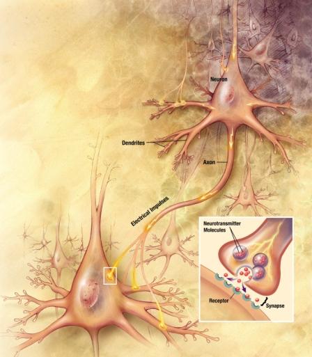 Alzheimer kór 39 Egészséges agy Súlyos Alzheimer kór Neuropatológia makroszkópos tünetek agy tömege csökken sulcusok tágabbak