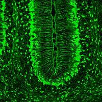 Bergmann glia hgfap-gfp - Golgi-féle epiteliális sejt = Bergmann glia - kisagy, radiális marad -
