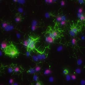 Oligodendrociták (ODC) és progenitorjaik (OPC) Markerek Olig2 Oligodendrocyte transcription factor 2 - bhlh transzkripciós faktor - ventrális neuroektodermális sejtsors specifikáció (motor neuron és