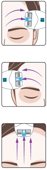 A KEZELÉS MENETE Az 1-es zóna kezelése A szem feletti területen, belülről kifelé haladjon a homlokán a kezelőgörgőkkel a