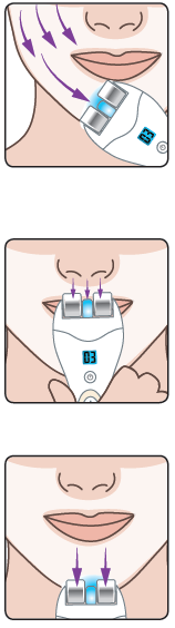 A 2-es zóna kezelése A KEZELÉS MENETE Térjen át az állkapocs és az áll területére az arca egyik felén, felülről lefelé és a száj irányába befelé haladva.