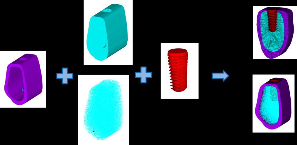 4. A fogászati implantátumok körüli csont viselkedése 4.3.