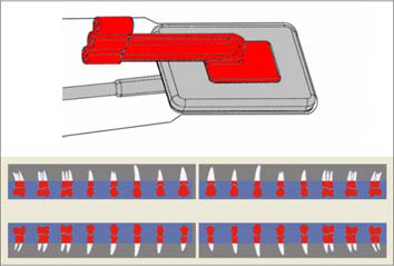 5 Üzemeltetés 5.6.3 Szárnyasfilm felvétel Szárnyasfilm felvételhez használja a piros szenzortartót. 1. Helyezze a piros lokalizáló gyűrűt (B) az egyenes vezető rúdra (C). 2.
