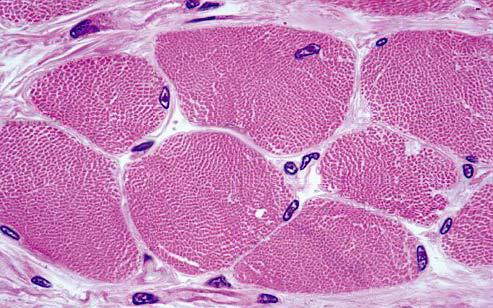 Az izom beidegzése, működése idegset nyúlványa nyúlványvégződés szinapszis ideg-izom áttevődés sejthártya szinapszis