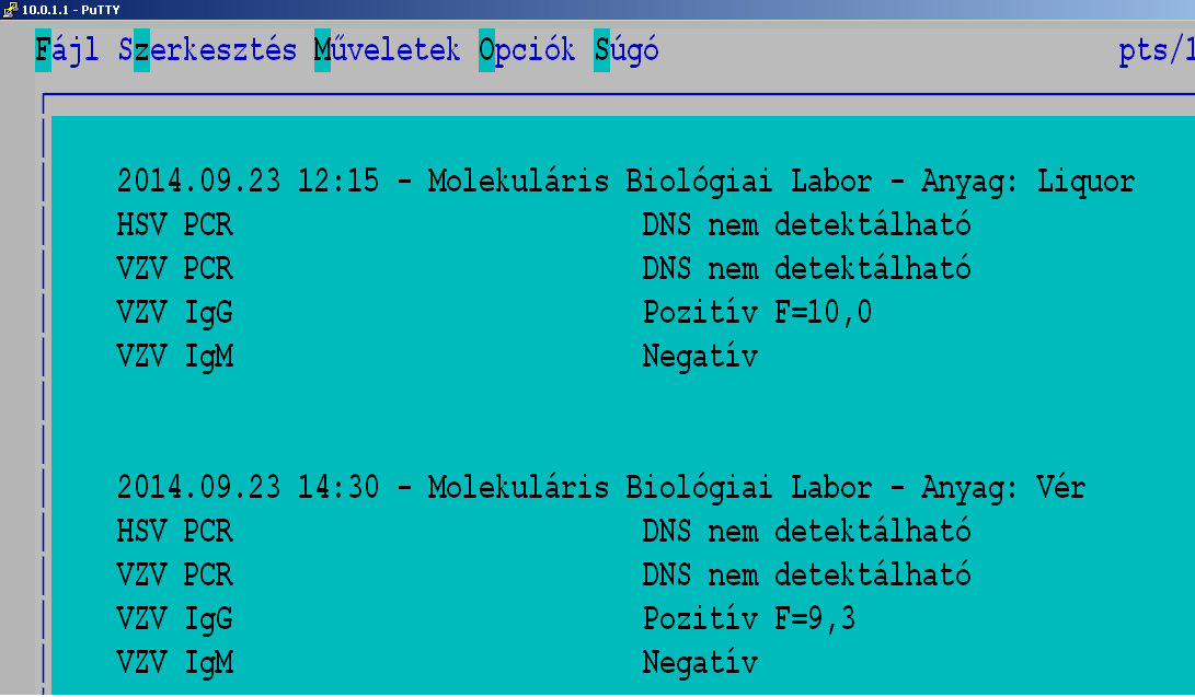 Intrathecalis