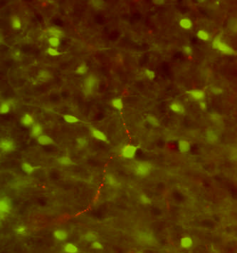 CART peptid (piros) és GAD-GFP (zöld) kapcsolata immunfluoreszcens mikroszkópban: piros boutonok a zöld sejt dendritjén Galanin(piros) és GAD-GFP (zöld) kapcsolata konfokális mikroszkópban: piros