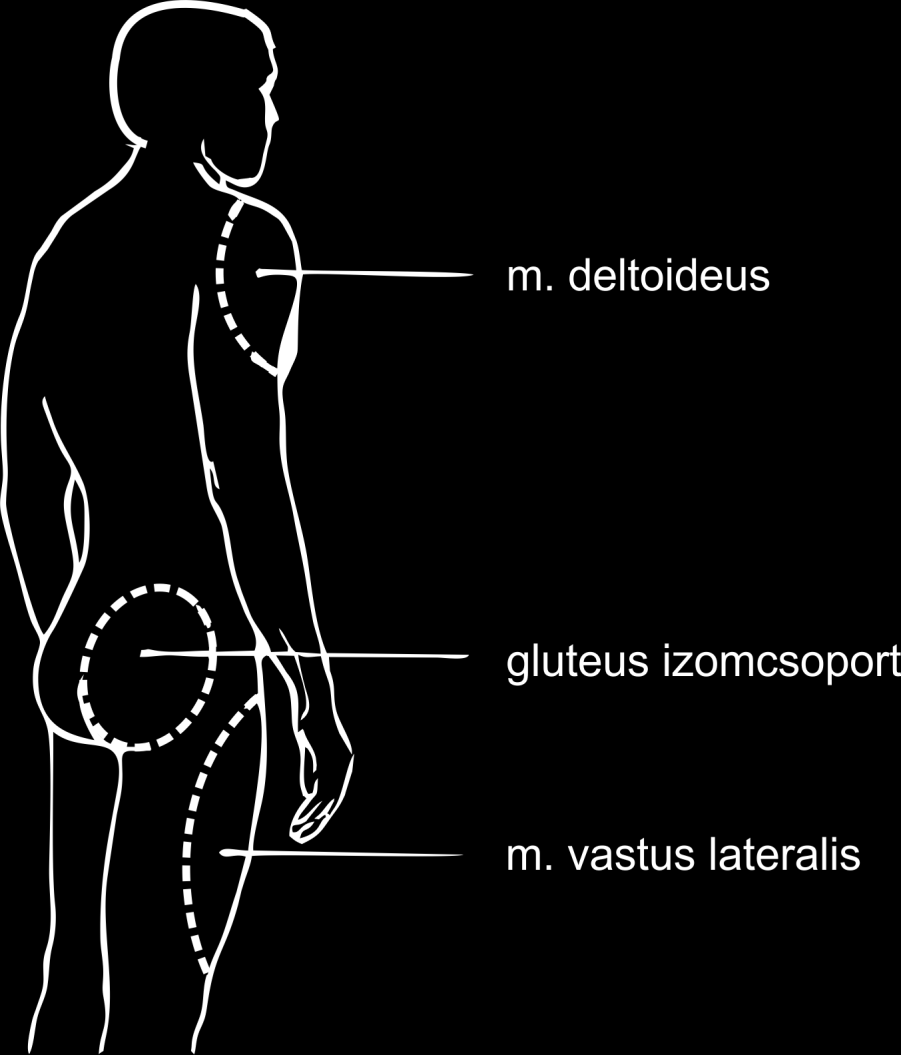 Ágyban hanyatt fekvő betegnél a ventralis glutealis régióba adjuk az injekciót.