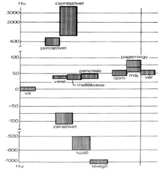 Pásztázás V Elektronsugár CT (V. generáció) Wolfram gyűrű Detektorok 216 köríven http://gotoknow.org/file/xraypsu/800px-spiral_ct.jpg http://kabayim.com/images/spiralct.