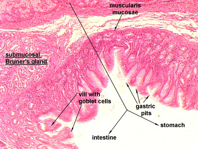 Epithelium típusai: Többrétegű el nem szarusodó laphám: szájüreg Többrétegű elszarusodó laphám: nyelőcső, kidörzsölődés megakadályozása