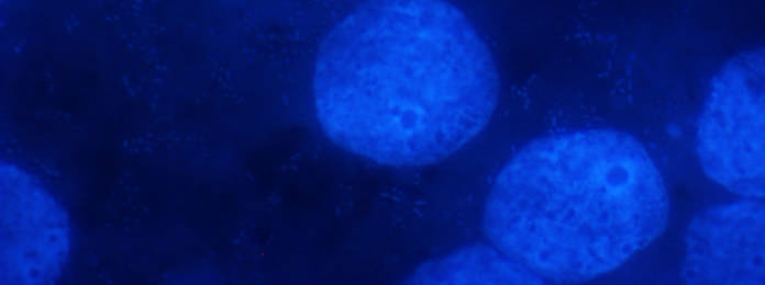 7 Nomarsky DAPI festés L.