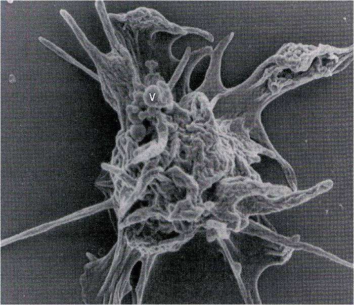 Thrombocyta adhézió Adhéziós molekulák a thrombocyta felszínén: P-selectin, Glycoproteinek, collagen receptorok Adhéziós faktorok az érfalban Collagen von Willebrand Factor (vwf) Egyéb