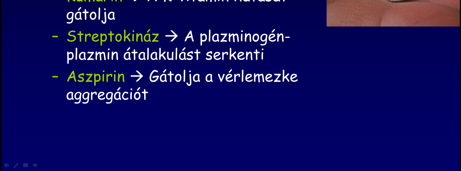 Hemophilia B: IX Factor defektus, ugyancsak X kromoszómához kötött 2. Fokozott koagulációs tendenciák 1. Thrombus & Embolus 1.
