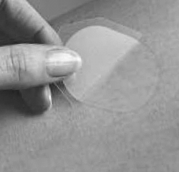Opioid hatóanyagok jellemző eliminációs sebessége Hagyományos hatóanyagleadás Bifázisos hatóanyagleadás Állandó sebességő hatóanyagleadás Fájdalom Idı erős opioidok ± NSAID ±adjuváns gyenge opioidok