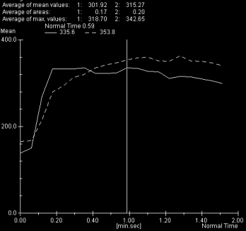 32 másodperccel a JZ halmozásának kezdete után a két intenzitás keresztezi egymást és attól fogva a külső MM mutat fokozottabb halmozást. 16.