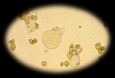 Haploid szövettenyésztési technikák A növényi gametophyton In