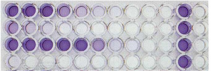 ELISA (enzyme linked immunosolvent assay) T Antigén vagy antitest jelenlétének megállapítása +/- Élelmiszer allergének kimutatása +/- Drog