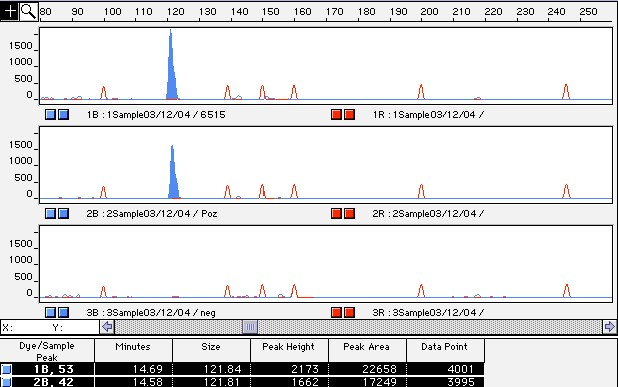 4.1.2. Fluoreszcens PCR és DNS fragmens analízis A fluoreszcens PCR és a DNS fragmens analízis paramétereit optimalizáltam.