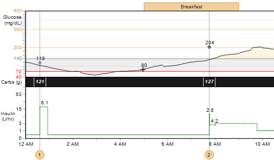 Glukóz, szénhidrátok és inzulin Ez a grafikon áttekintést ad a beteg vércukorszintjeiről, szénhidrátbeviteléről és inzulinhasználatáról a kiválasztott nap folyamán.