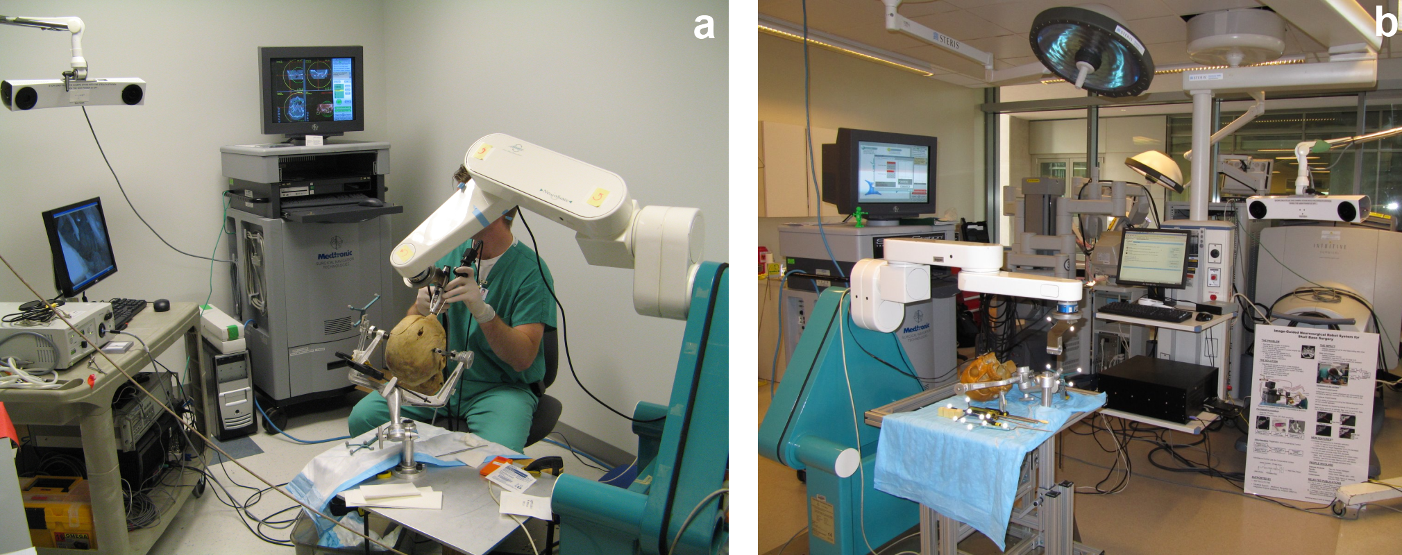 6 2. ábra. A NeuroMate robotra épülo IGS rendszer a Johns Hopkins University-n. (a) A NeuroMate holttestkísérlet (koponyafúrás) közben a JHMI kórházban. (b) A komplett JHU rendszer a R. A. Swirnow Mock Operating Room demonstrációs laborban a Hopkinson, Baltimore-ban.