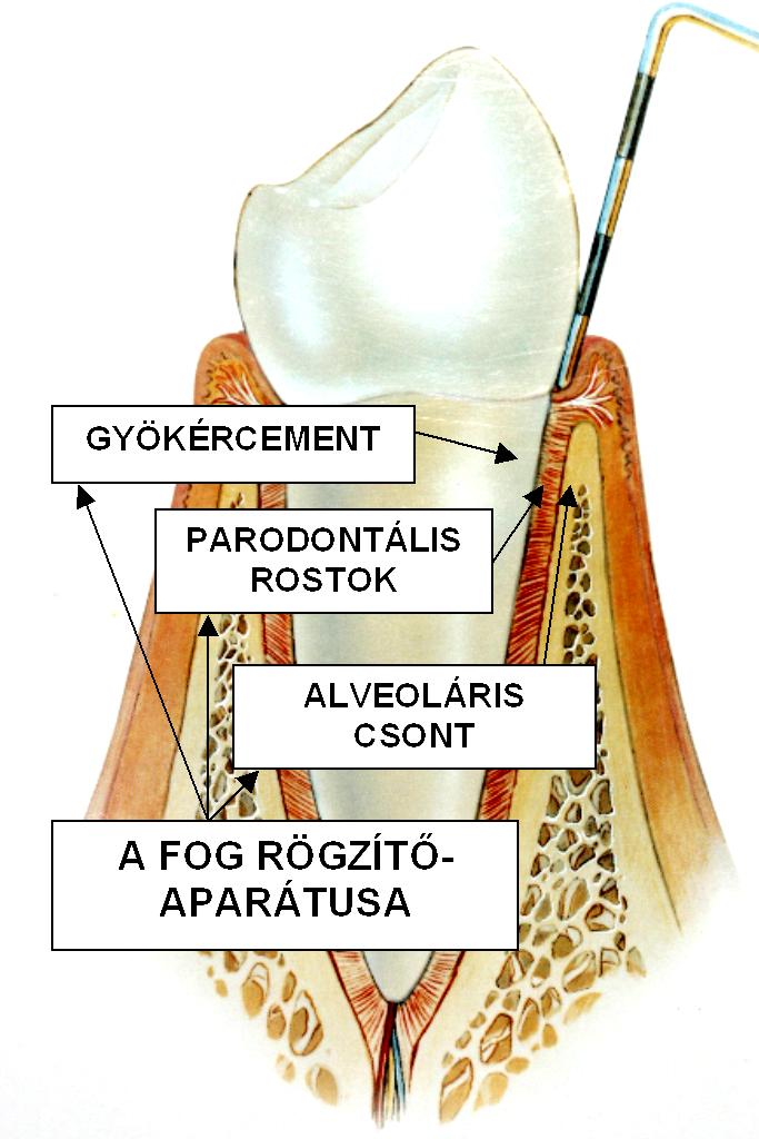 A rögzítő aparátus részei 1. Gyökércement 2.