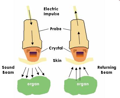 Ultrahang diagnosztika Impulzus-echo módszerek alapja UH impulzus visszaverődés visszatérő jel (echo) detektálása (amplitúdó, visszatérési idő, frekvencia eltolódás) jel erősítése és feldolgozása