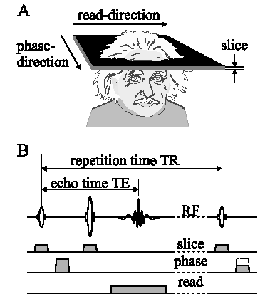 2D Fourier transzformációs eljárás Gyakorlatban ezt alkalmazzák 90 180 szeletkijelölő gradiens