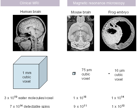 Mágneses rezonancia mikroszkópia (μmri vagy MRM) MRI kisebb mérettartományban térbeli felbontás: 100 μm 3 Tesla,