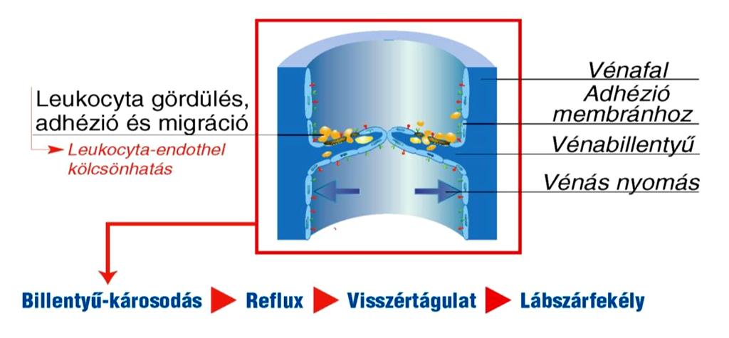 A vénás reflux eredete Billentyűkárosodás Leukocyta-endothel interakció a