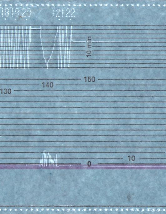 4. ábra: az eseményben érintett vágányhálózat torzított helyszínrajza Az ábrán a felső két vágány a helyi elnevezésekben és a továbbiakban kihúzó és a szerencsi. Vágánytengely-távolságuk 4,7 m. 1.