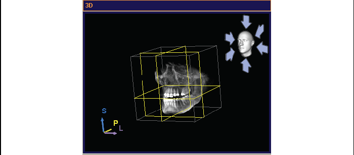 7 Nézetek 7.2.1 3D-s nézet a munkafelületen 3D-s panoráma nézet 3D-s radiológiai nézet 7.