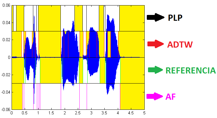 Gyenge minőségű beszéd szegmentálása DOI: 10.14750/ME.2015.017 32 egyes szegmentálási eljárásokra 0 ms-os tűréssel vizsgáltam az ilyen jellegű hibákat.