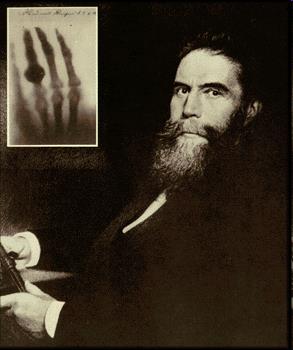 Röntgen (X-ray) sugárzás Sugárzás